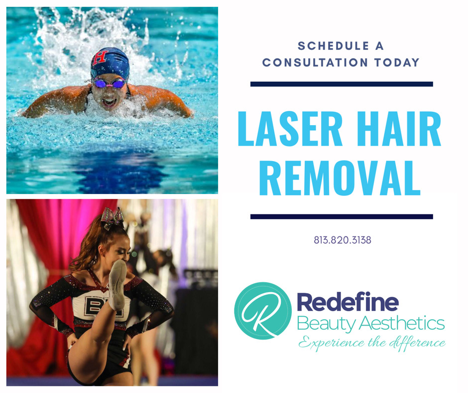 Laser Hair Removal and Sports Redefine Beauty Aesthetics