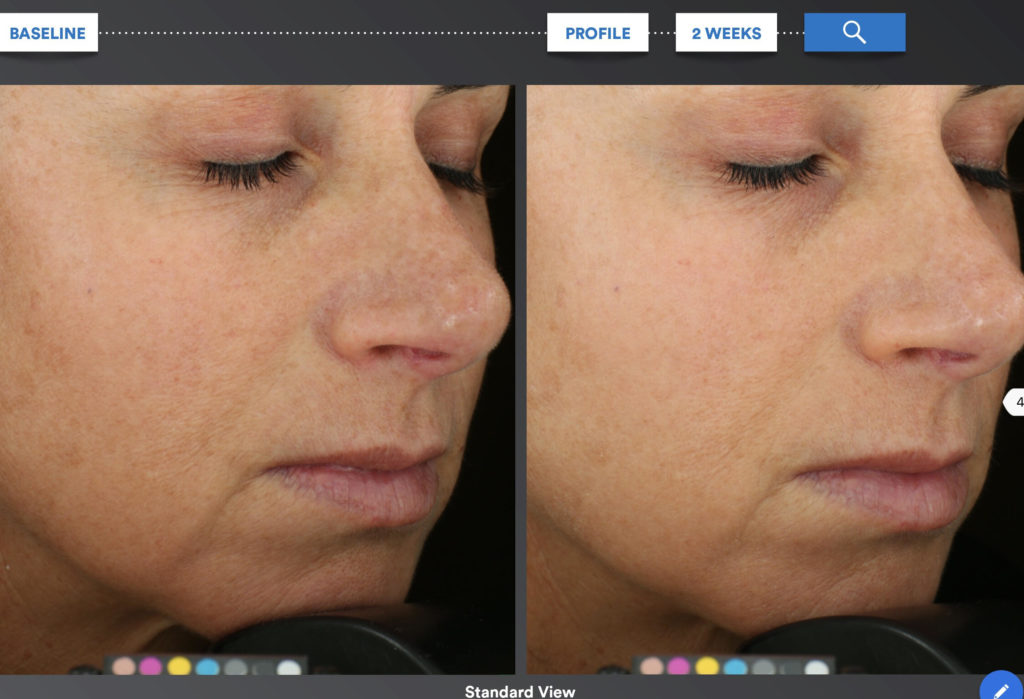 sente bio complete serum before and after